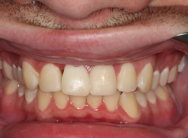 After -  Graystone Referral Centre