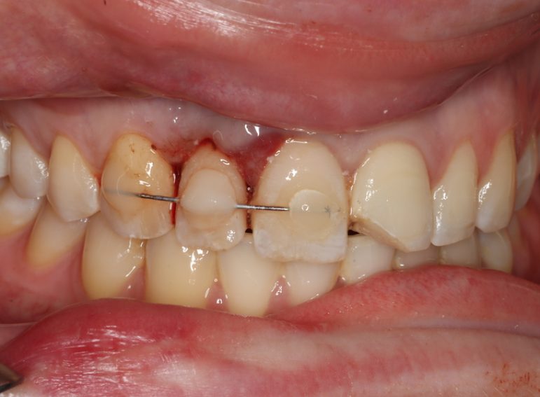 After -  Graystone Referral Centre