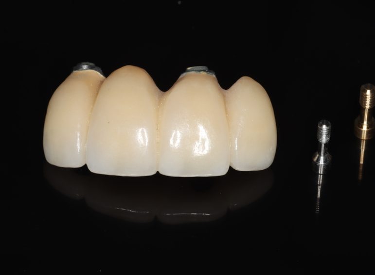 Before -  Graystone Referral Centre