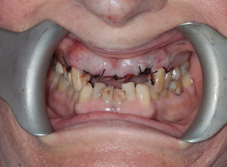 After -  Graystone Referral Centre