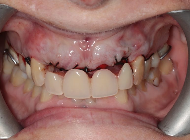 After -  Graystone Referral Centre