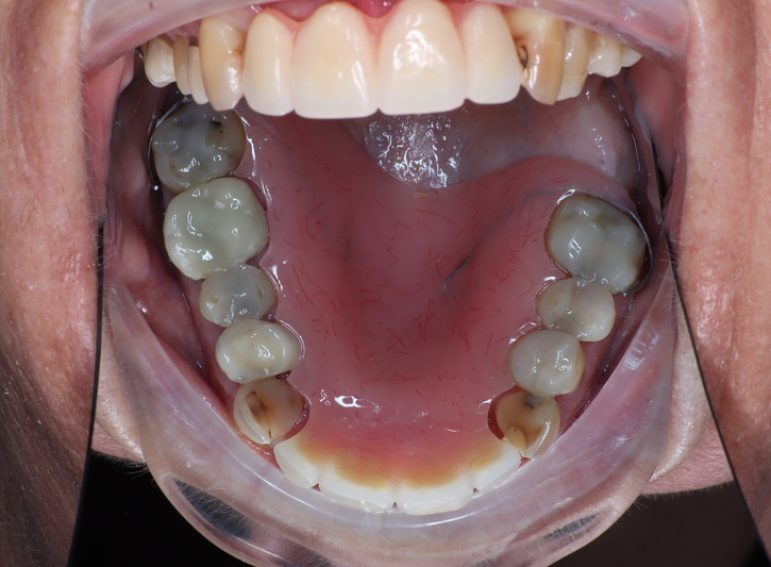 After -  Graystone Referral Centre