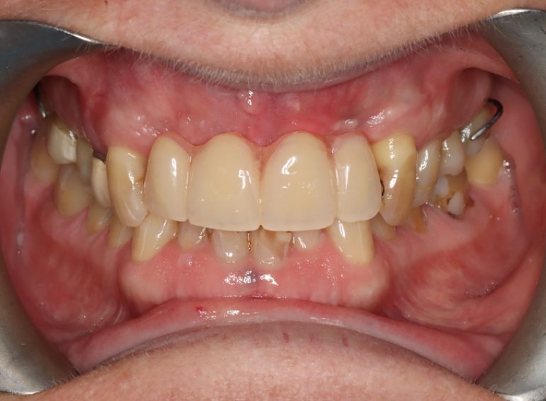 Before -  Graystone Referral Centre