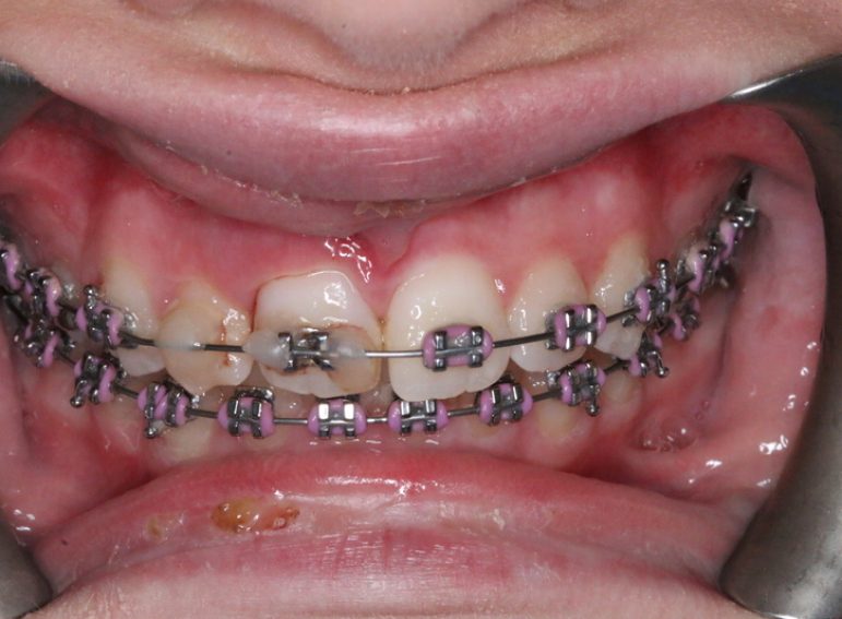 After -  Graystone Referral Centre