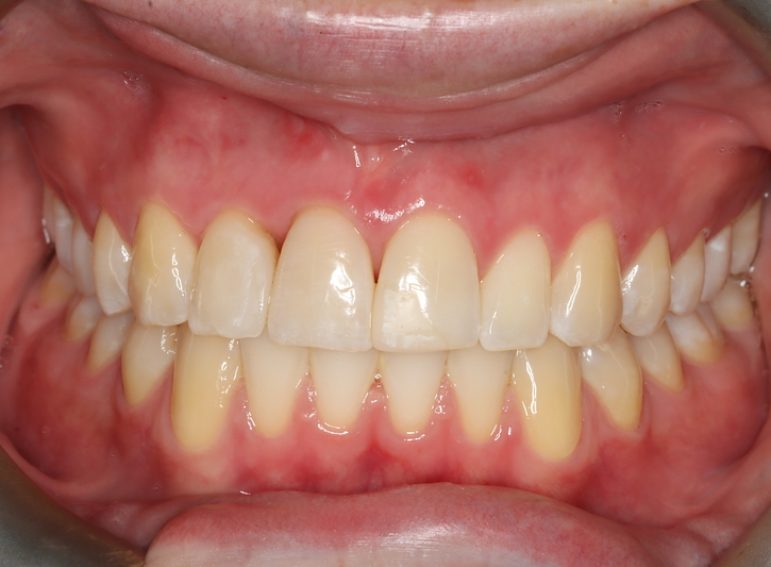 Before -  Graystone Referral Centre