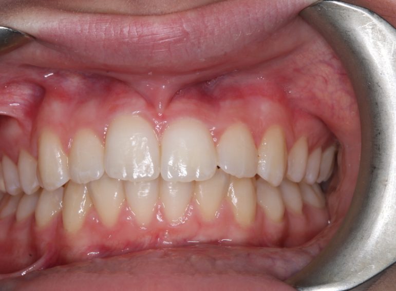 After -  Graystone Referral Centre