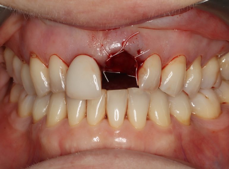 After -  Graystone Referral Centre