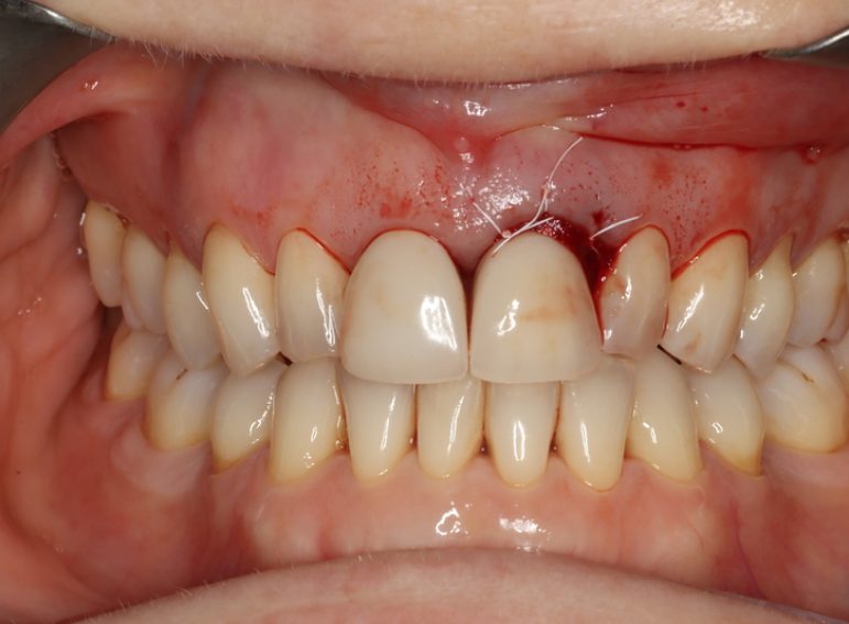 Before -  Graystone Referral Centre