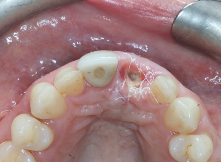 Before -  Graystone Referral Centre