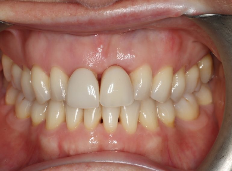 Before -  Graystone Referral Centre