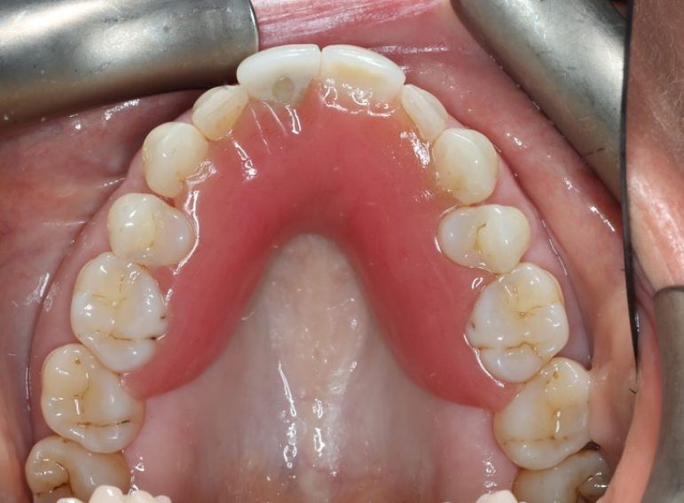 After -  Graystone Referral Centre