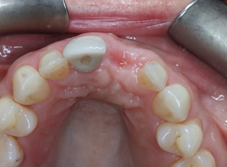 After -  Graystone Referral Centre