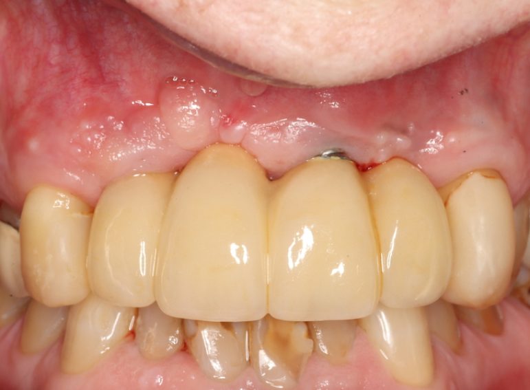 Before -  Graystone Referral Centre