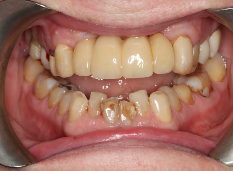 Before -  Graystone Referral Centre