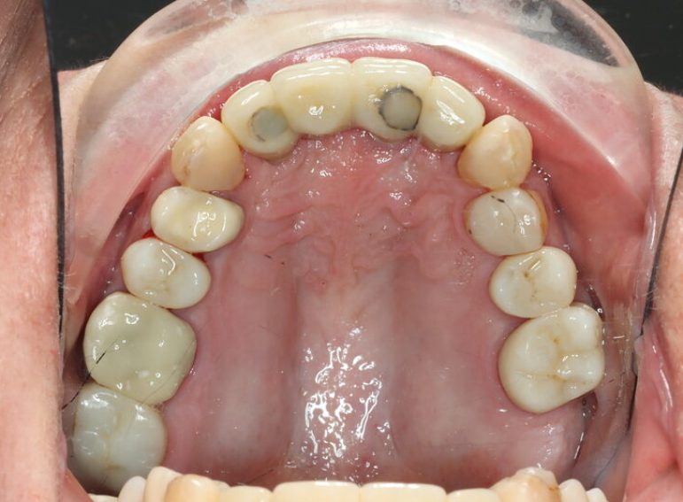 After -  Graystone Referral Centre