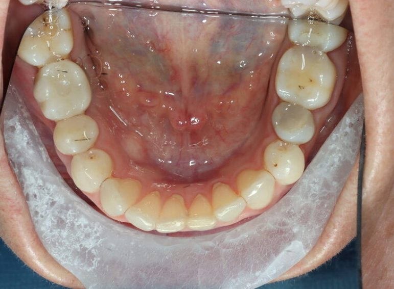 Before -  Graystone Referral Centre