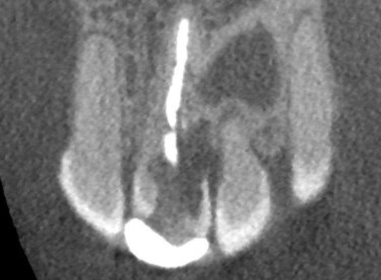 After -  Graystone Referral Centre