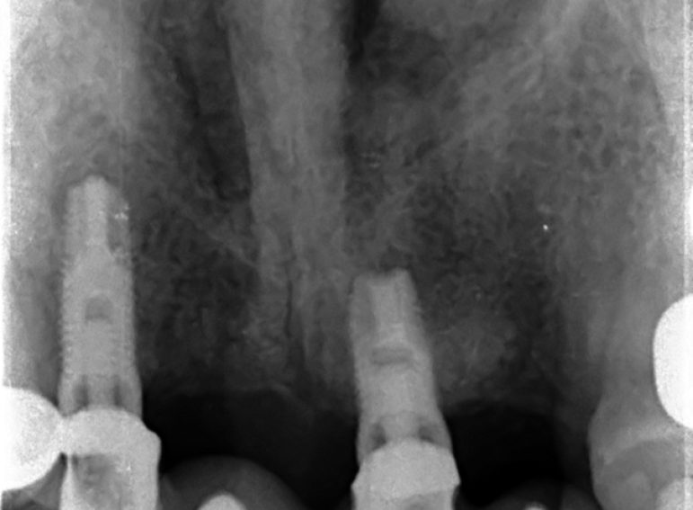 Before -  Graystone Referral Centre