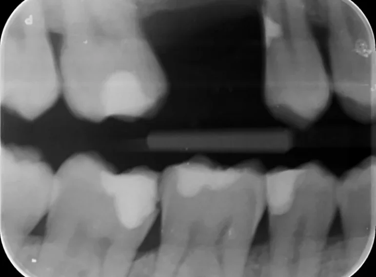 Before -  Graystone Referral Centre