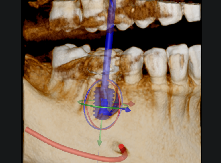 Before -  Graystone Referral Centre
