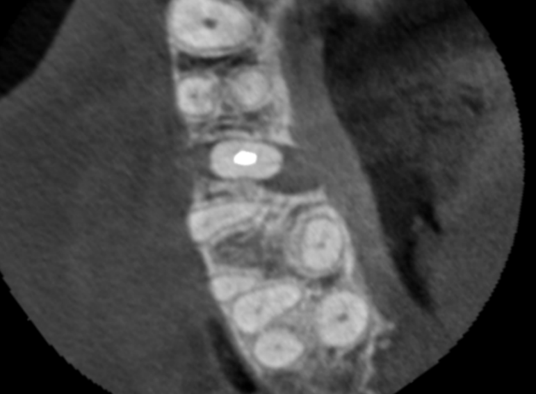 Before -  Graystone Referral Centre