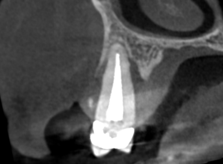 After -  Graystone Referral Centre