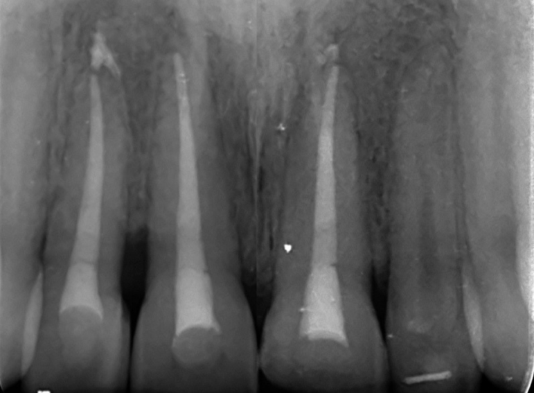 After -  Graystone Referral Centre