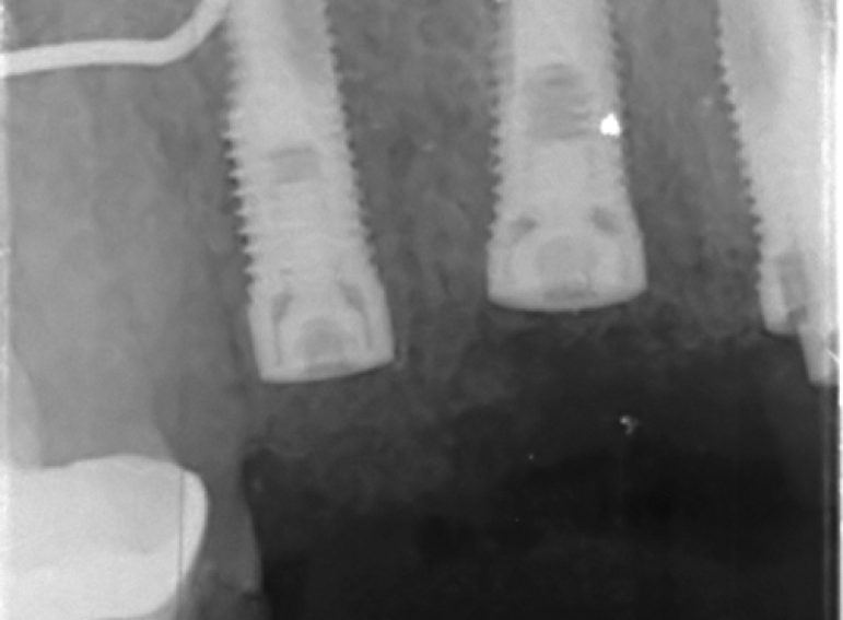 After -  Graystone Referral Centre