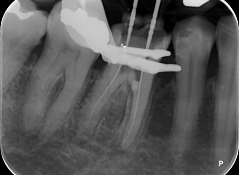 Before -  Graystone Referral Centre