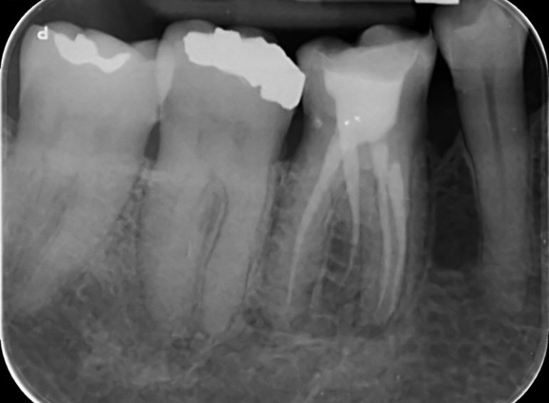 After -  Graystone Referral Centre