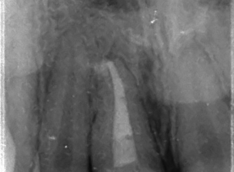 Before -  Graystone Referral Centre