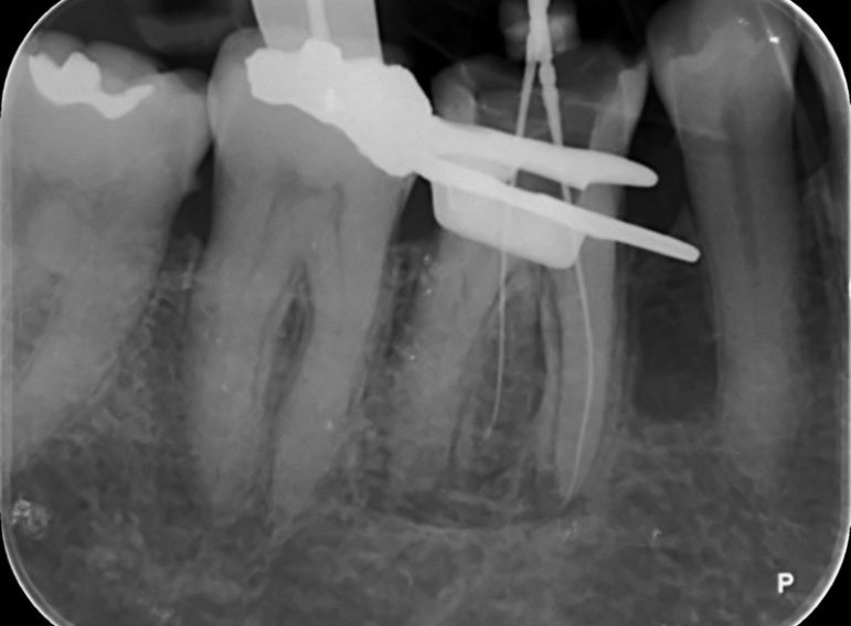 After -  Graystone Referral Centre