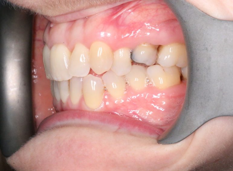 After -  Graystone Referral Centre