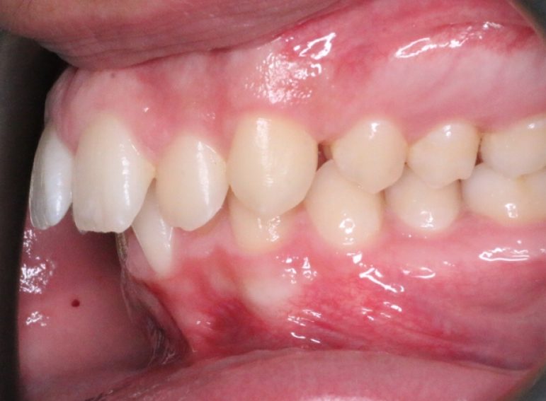 After -  Graystone Referral Centre