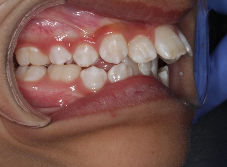 After -  Graystone Referral Centre