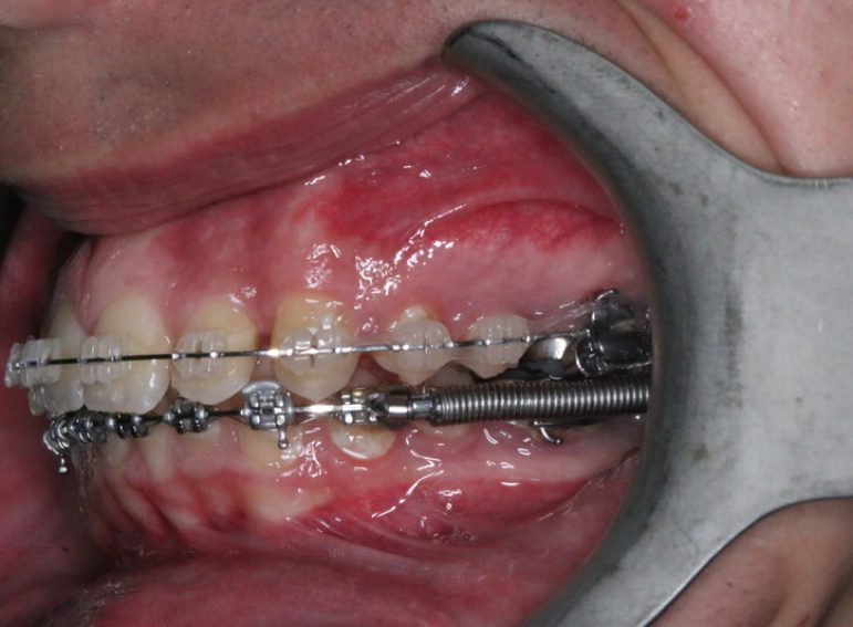 After -  Graystone Referral Centre