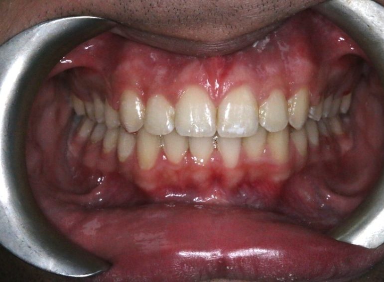 Before -  Graystone Referral Centre