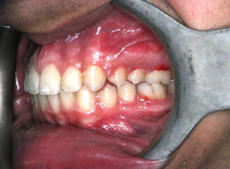 Before -  Graystone Referral Centre