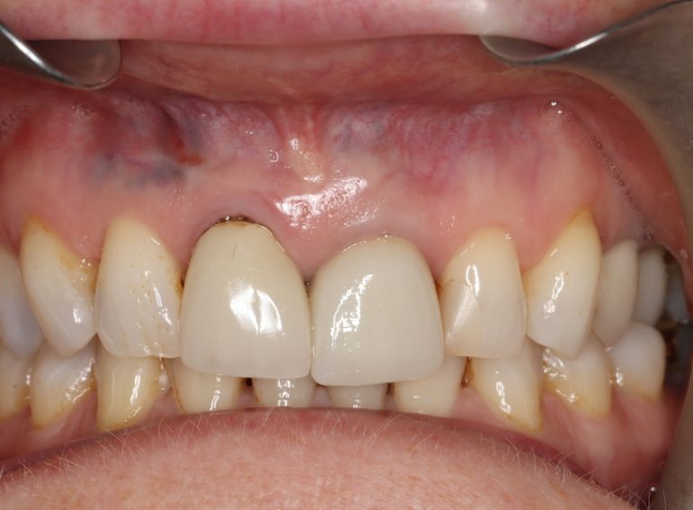 After -  Graystone Referral Centre