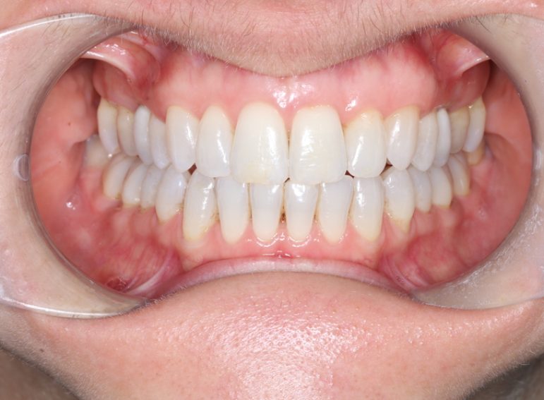 Before -  Graystone Referral Centre