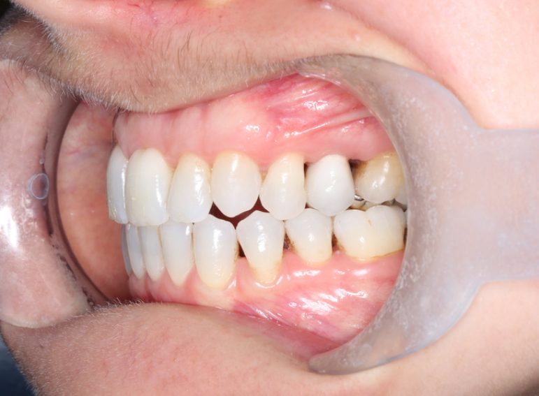 After -  Graystone Referral Centre