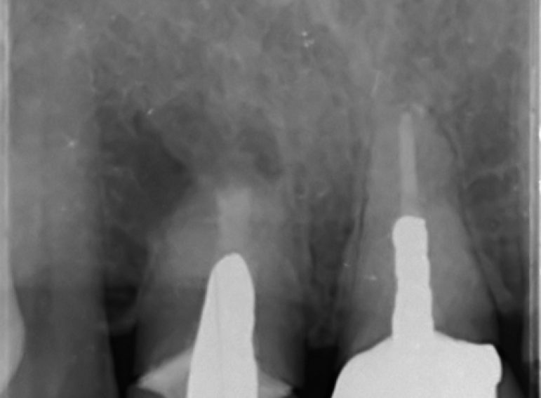 Before -  Graystone Referral Centre