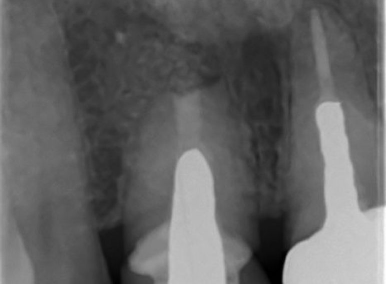 After -  Graystone Referral Centre