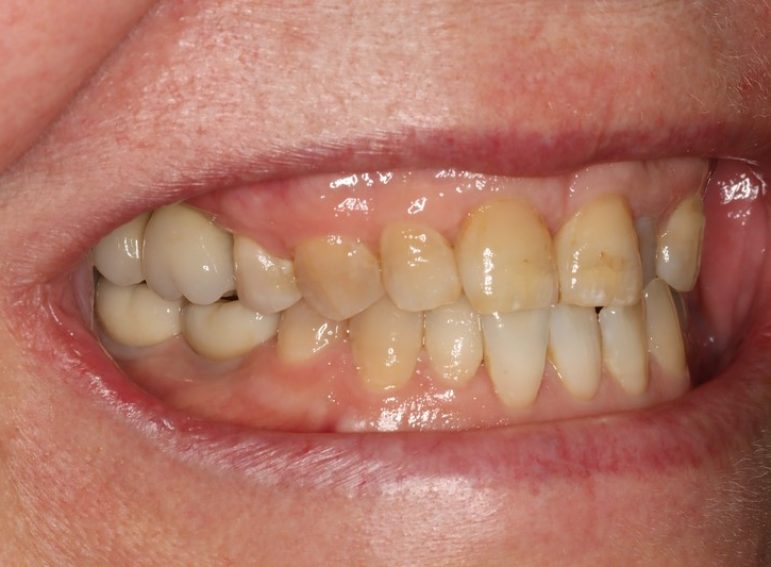 After -  Graystone Referral Centre