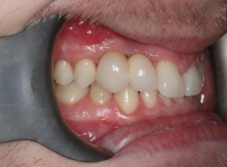 After -  Graystone Referral Centre