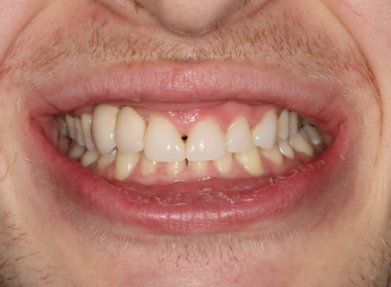 Before -  Graystone Referral Centre