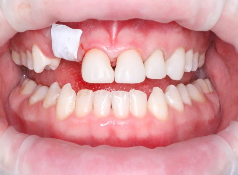 After -  Graystone Referral Centre