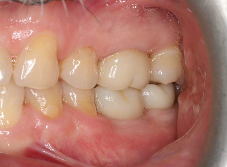 After -  Graystone Referral Centre