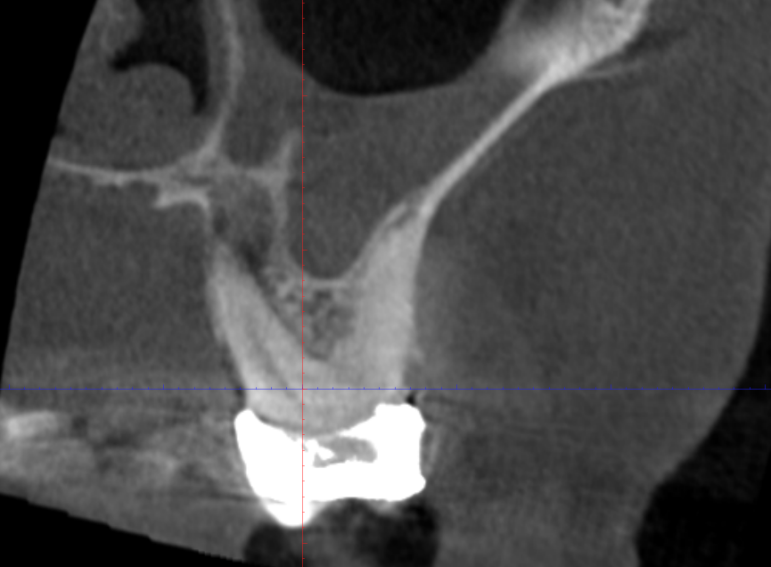After -  Graystone Referral Centre