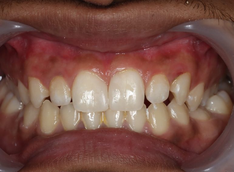 After -  Graystone Referral Centre